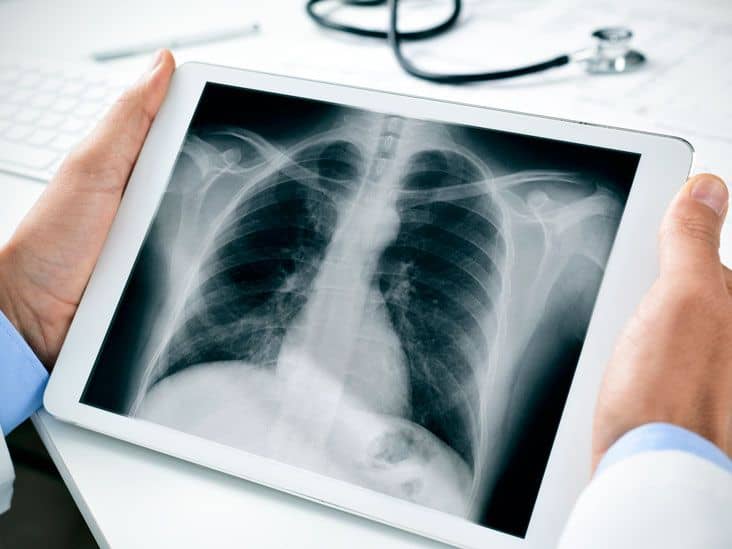 X-ray Imaging